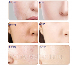 Маска для лица с экстрактом слизи улитки, обновление и восстановление кожи. Маска для лица с экстрактом слизи улитки, обновление и восстановление кожи.